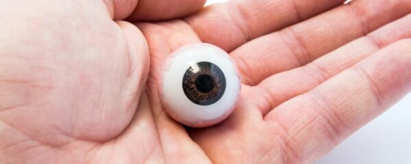 Prothèse oculaire